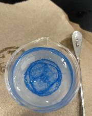 Bioprinting with hydrogels