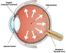 Eye diagram