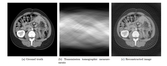 Ultrasound Imaging